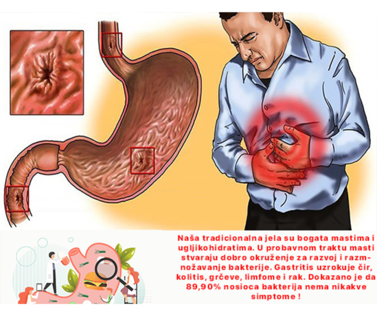 Kapsule za gastritis Gastronormal